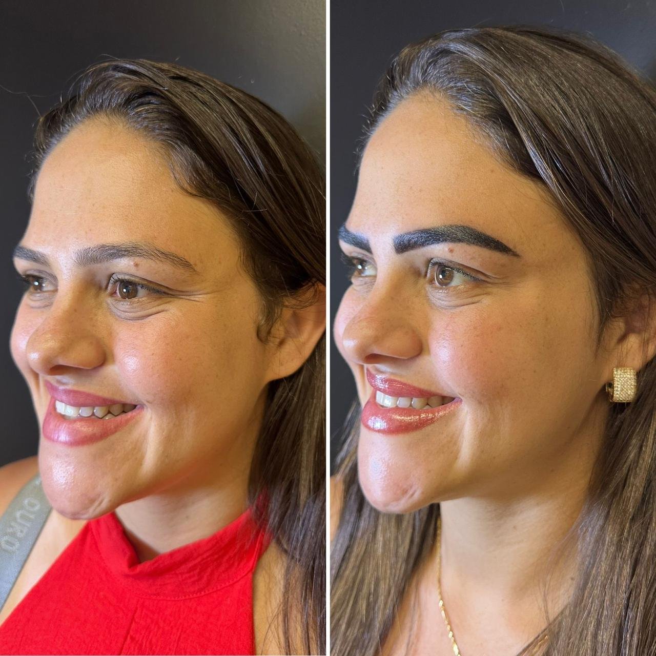 Resultado antes e depois