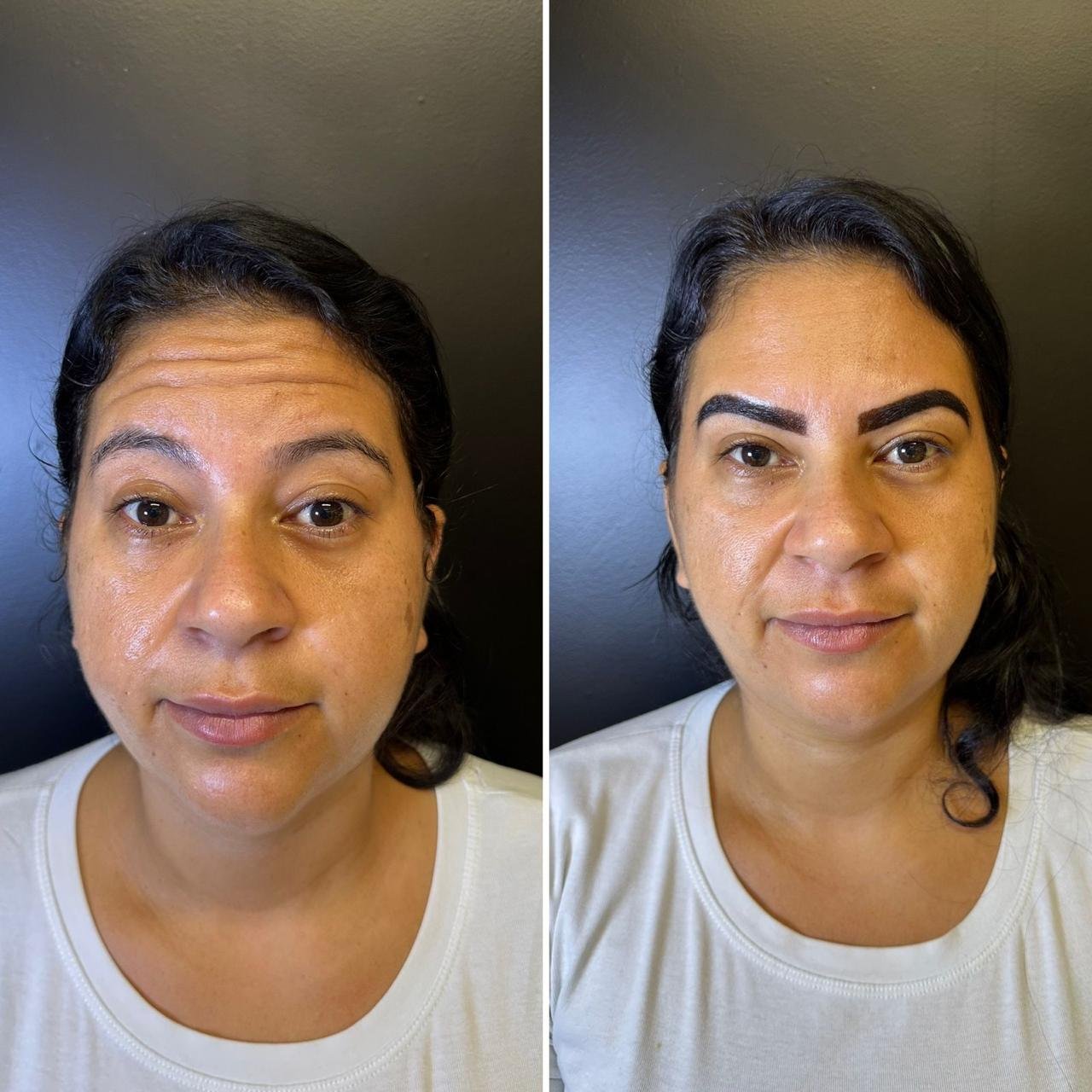 Resultado antes e depois