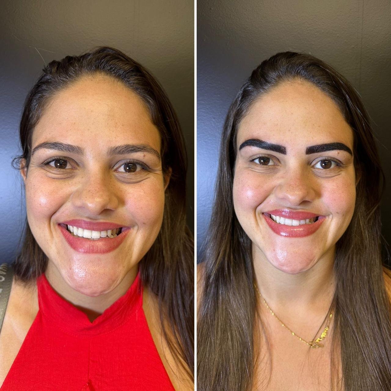 Resultado antes e depois