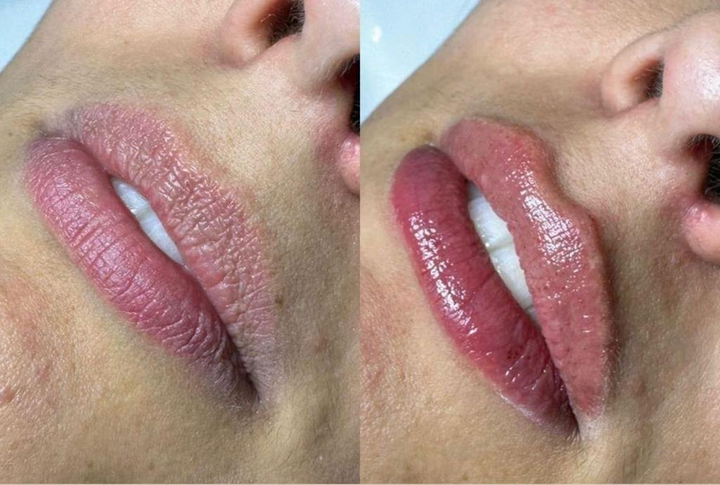 Resultado antes e depois